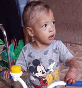 Pequeno Gui conta com a solidariedade dos moradores da região para a realização de cirurgia. Foto: Divulgação